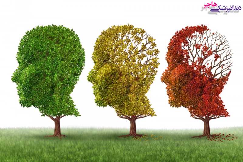 آلزایمر یکی از دلایل خشکی دهان است